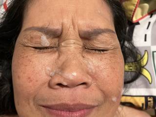 Facial aftermath