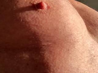 Cold morning - could do with someone to suck on both of .them!