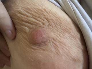 My nipple