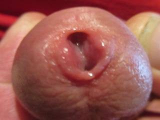 Peehole
