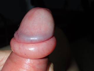 I thought I would post an after photo of my cock head and foreskin.  I was playing with my penis pump.  Any comments?