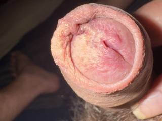 You can play with my foreskin anytime