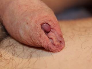 A close up of my puckered foreskin