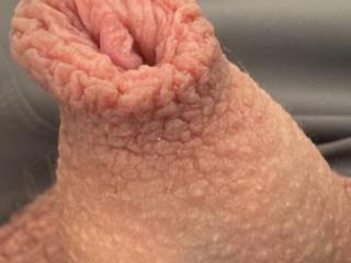 Long foreskin