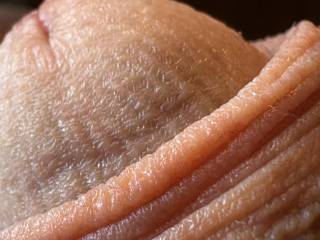 Close up glans and foreskin.