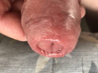 Closeup of mu pumped head. Love the thickness of my foreskin. Would you like to play with it.  let me know what else you think I could try.