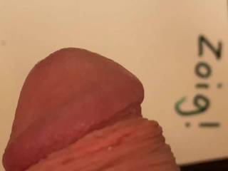 A zoig dick