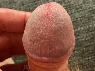 Now here is an unusual sight, a totally flaccid glans.