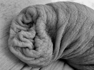 Soft power of skin