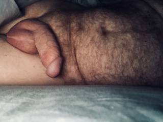 Woke up with a swollen penis and took a photo for you.