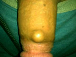 I have a marble implanted it make's women squirt every time!