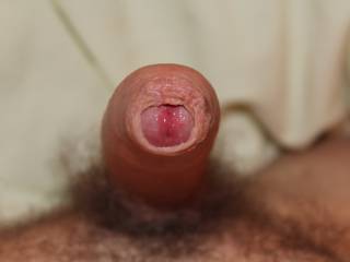 Self supporting foreskin closeup