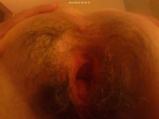 The wife has a huge gaping hairy pussy, easy arm fisting for friends