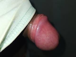 lollipop