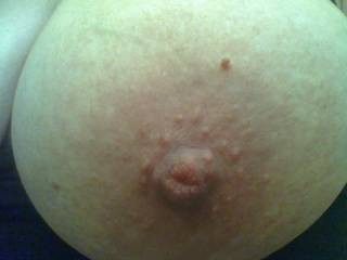 nipple closeup