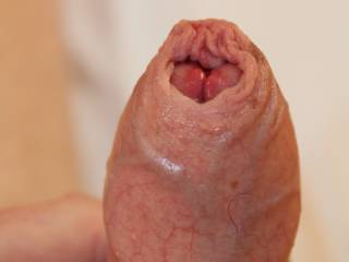 I think that you are the cause of this swelling so maybe you should deal with it too.