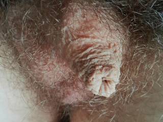 My hairy tiny dick and foreskin,small testikles