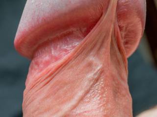 Most sensitive frenulum
