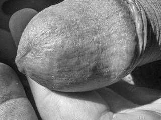 dick