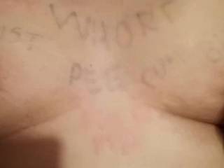 will u leave some scars?