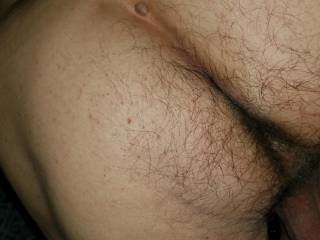 Hairy hole