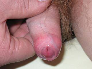 I luv to suck a uncut cock,,,,,, nothing like it,,,,,,,,,,,,,,,,,,,,,,,,,,