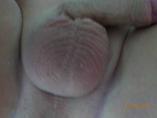 my balls what do you think