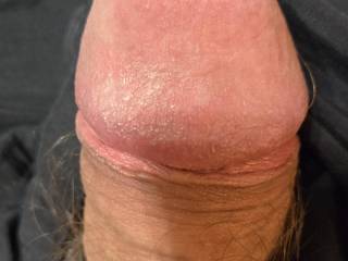 Pic of non erect.