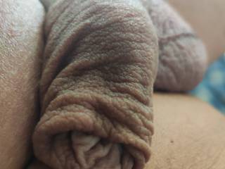 Good morning, foreskin fans