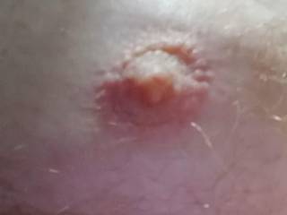 My Hard Nipple For Your Pleasure....💦👅💦👅💦👅😛😜😋👌👌👍👏