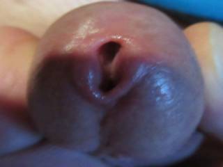 My Head
