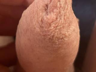 Mr Floppy 100% relaxed with his foreskin totally puckered up and untouched.