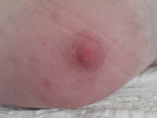 one of my erect nipples