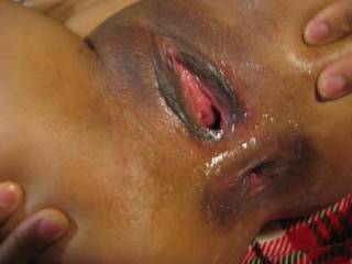 Alicia\'s holes After ;)