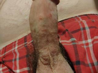 This cock is so hard I need a friend!