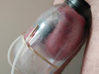 Been into genital vacuum pumping for a long time now, it\'s one of my favorite things to do.