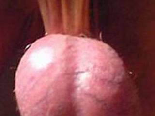 Out of Lovolust's Blusheroticon; subject: My balls, eggs, scrotum, testix - real, unfaked, true & genuine picts - from funny through sexy-porny up to brutal; it is for the Women: ...