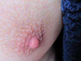 a male nipple....