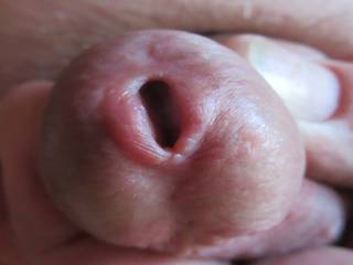 My Peehole