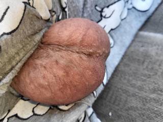 My sack needs drained