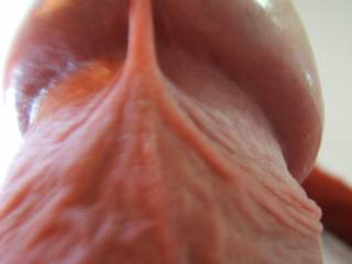 The frenum (frenulum)