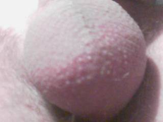 An extreme close-up of my shaved balls.