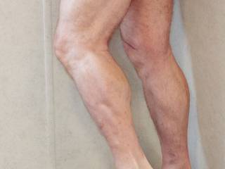 Ms. Doooobe says I have great legs and women on Zoig say they want more than dick pics. These are my 68 year-old legs.