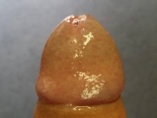 wet and forskin back