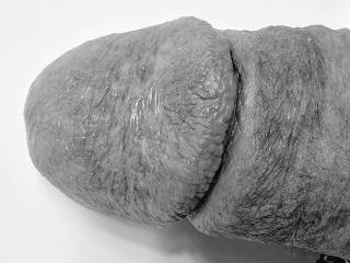 Head
