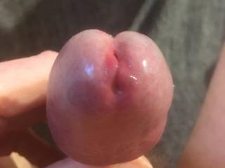 look what you have done to my glans, it feels very swollen.