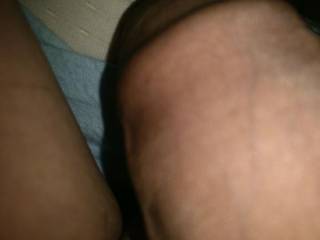 My foreskin