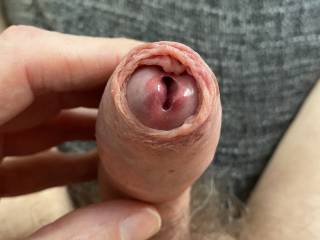 'He' is stiffening up now, and the foreskin just forms a halo around the open meatus lips. Which could be an ominous warning.