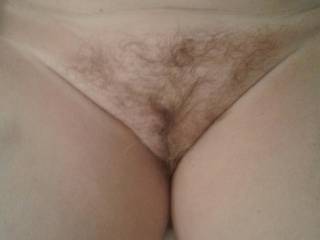 As requested...hairy