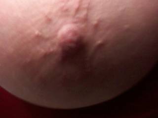 Another closeup of Barb\'s nipple